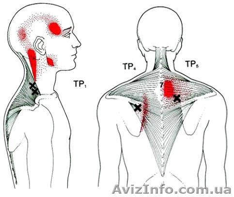 массаж классический баночный - <ro>Изображение</ro><ru>Изображение</ru> #1, <ru>Объявление</ru> #673386