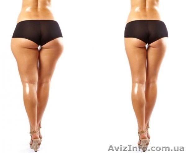 Антицеллюлитный массаж. Качественно и результативно. - <ro>Изображение</ro><ru>Изображение</ru> #1, <ru>Объявление</ru> #785098