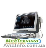 Портативный УЗИ аппарат Mindray DP-50 - <ro>Изображение</ro><ru>Изображение</ru> #1, <ru>Объявление</ru> #813148