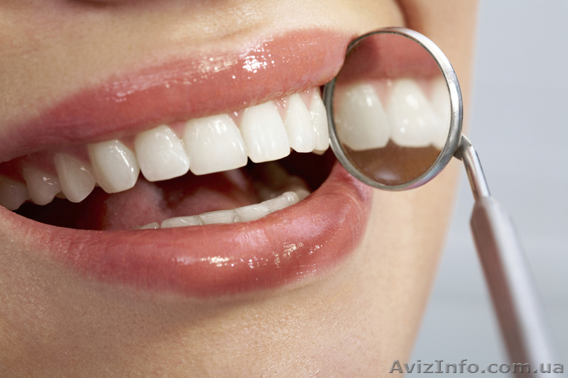 Услуги стоматолога - <ro>Изображение</ro><ru>Изображение</ru> #1, <ru>Объявление</ru> #868585