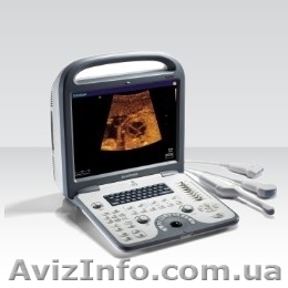 Портативные цветные УЗИ сканеры SonoScape - <ro>Изображение</ro><ru>Изображение</ru> #1, <ru>Объявление</ru> #1064070