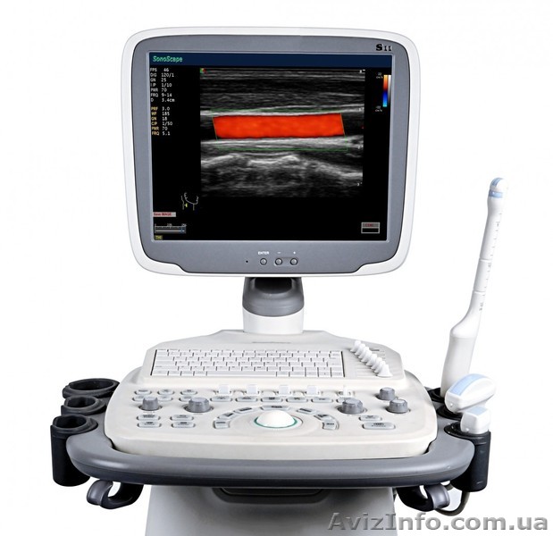 Цветной Узи сканер SonoScape S11 - <ro>Изображение</ro><ru>Изображение</ru> #1, <ru>Объявление</ru> #1056162