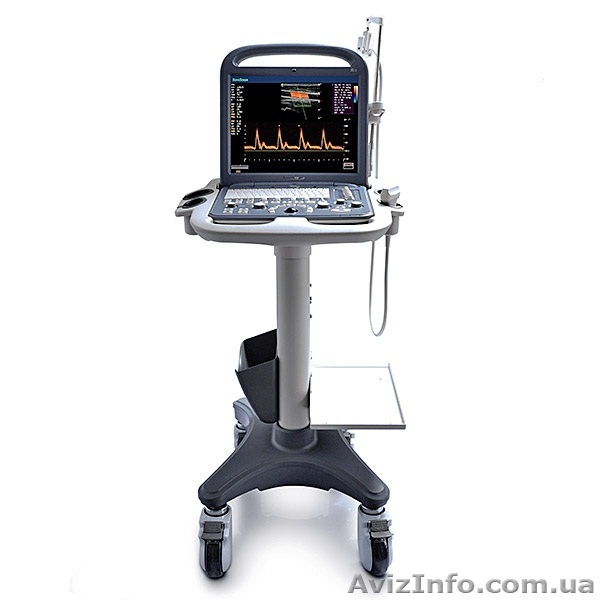 УЗИ сканеры Sonoscape в Украине - <ro>Изображение</ro><ru>Изображение</ru> #1, <ru>Объявление</ru> #1080704