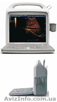 Портативный серошкальный аппарат УЗИ iuStar 160 (B/W) - <ro>Изображение</ro><ru>Изображение</ru> #1, <ru>Объявление</ru> #1076182