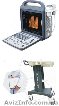 Портативный цветной аппарат УЗИ iuStar 160 - <ro>Изображение</ro><ru>Изображение</ru> #1, <ru>Объявление</ru> #1075682