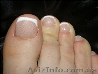 Наращивание ногтей на НОГАХ!!! - <ro>Изображение</ro><ru>Изображение</ru> #2, <ru>Объявление</ru> #632879