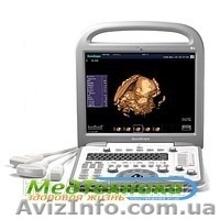 Узи аппараты по низким ценам - <ro>Изображение</ro><ru>Изображение</ru> #1, <ru>Объявление</ru> #794604