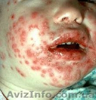 живая-трава - <ro>Изображение</ro><ru>Изображение</ru> #3, <ru>Объявление</ru> #805214