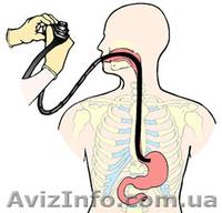 Фиброгастродуоденоскопия (ФГДС) - <ro>Изображение</ro><ru>Изображение</ru> #1, <ru>Объявление</ru> #1233781