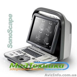 Портативный узи сканер A6 SonoScape черно-белый - <ro>Изображение</ro><ru>Изображение</ru> #1, <ru>Объявление</ru> #1011873