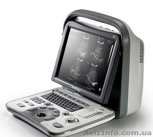 Аппарат УЗ-диагностики SonoScape A6 - <ro>Изображение</ro><ru>Изображение</ru> #2, <ru>Объявление</ru> #1078826