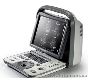Портативные черно белые УЗИ сканеры SonoScape - <ro>Изображение</ro><ru>Изображение</ru> #1, <ru>Объявление</ru> #1079402