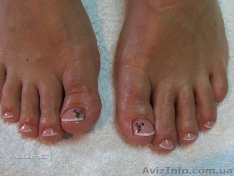 Наращивание ногтей на НОГАХ!!! - <ro>Изображение</ro><ru>Изображение</ru> #4, <ru>Объявление</ru> #632879