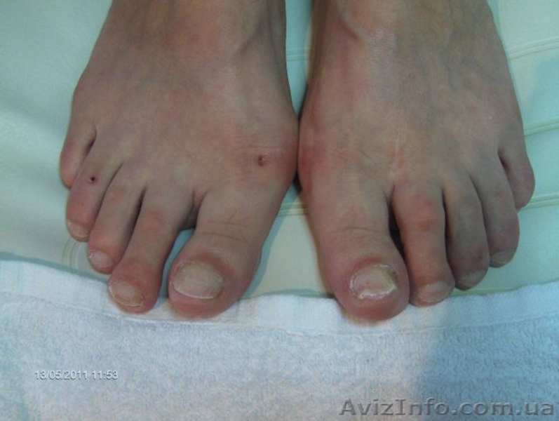Наращивание ногтей на НОГАХ!!! - <ro>Изображение</ro><ru>Изображение</ru> #3, <ru>Объявление</ru> #632879