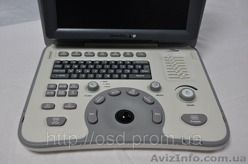 Портативный черно-белый узи сканер SonoScape A6 - <ro>Изображение</ro><ru>Изображение</ru> #2, <ru>Объявление</ru> #687748