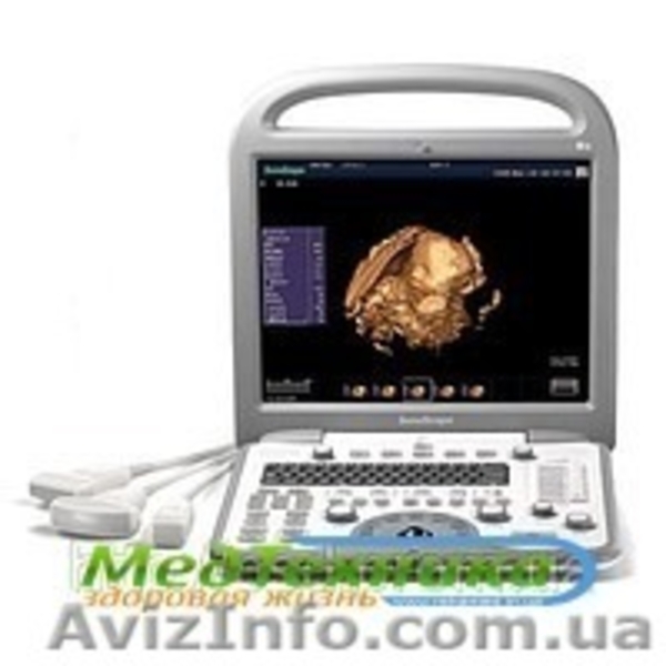 Узи аппараты по низким ценам - <ro>Изображение</ro><ru>Изображение</ru> #1, <ru>Объявление</ru> #794604