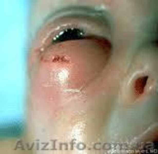 живая-трава - <ro>Изображение</ro><ru>Изображение</ru> #1, <ru>Объявление</ru> #805214