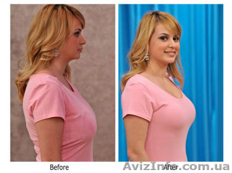 Наикомфортнеший бюстгальтер Genie Bra - <ro>Изображение</ro><ru>Изображение</ru> #4, <ru>Объявление</ru> #785216