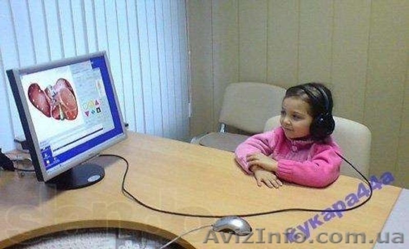 Аппарат Оберон 11 - <ro>Изображение</ro><ru>Изображение</ru> #2, <ru>Объявление</ru> #960908