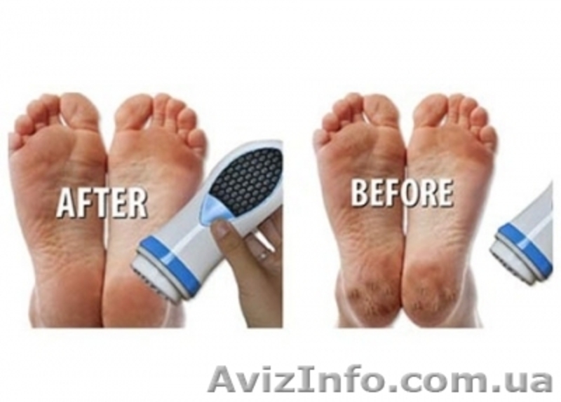 Прибор для домашнего педикюра Pedi Spin - педи спин. - <ro>Изображение</ro><ru>Изображение</ru> #3, <ru>Объявление</ru> #1062674